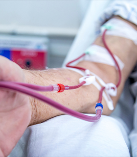 Hemodialysis Hemofiltration CRRT