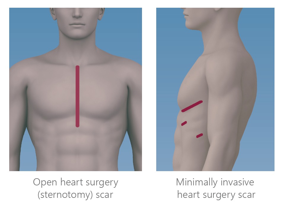 scars from 2 operations