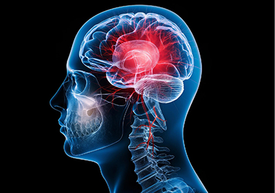 Symptoms, Causes, and Risk Factors of Parkinson’s Disease