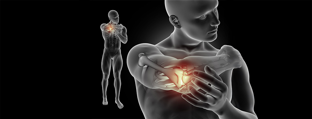 Delaying Joint Replacement: What You Need to Know 