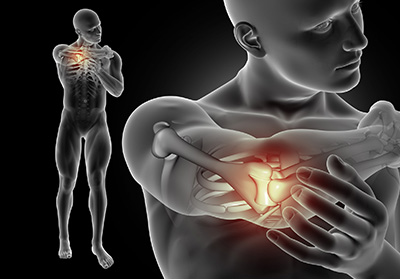 Delaying Joint Replacement: What You Need to Know 