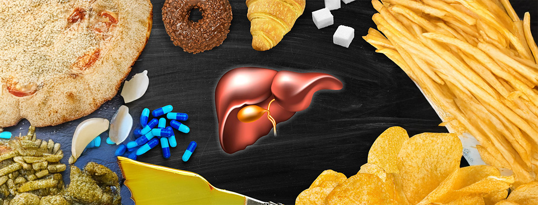 How Metabolic Dysfunctional-Associated Fatty Liver Disease (MAFLD) Puts You at Risk for Heart Attacks? 