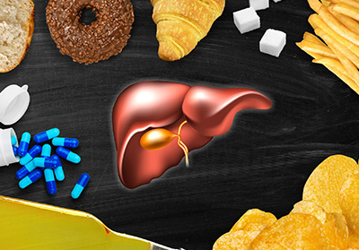 How Metabolic Dysfunctional-Associated Fatty Liver Disease (MAFLD) Puts You at Risk for Heart Attacks? 