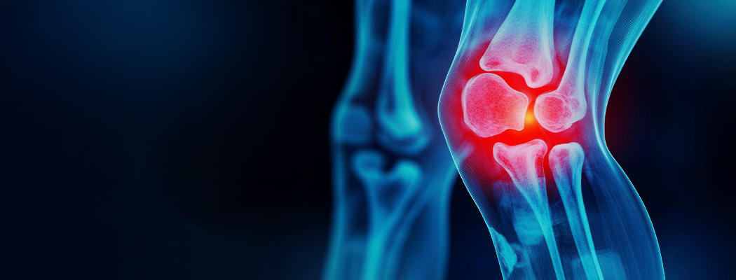 Physiotherapy vs Surgery for Joint Pain: Which Treatment Is Right for You?