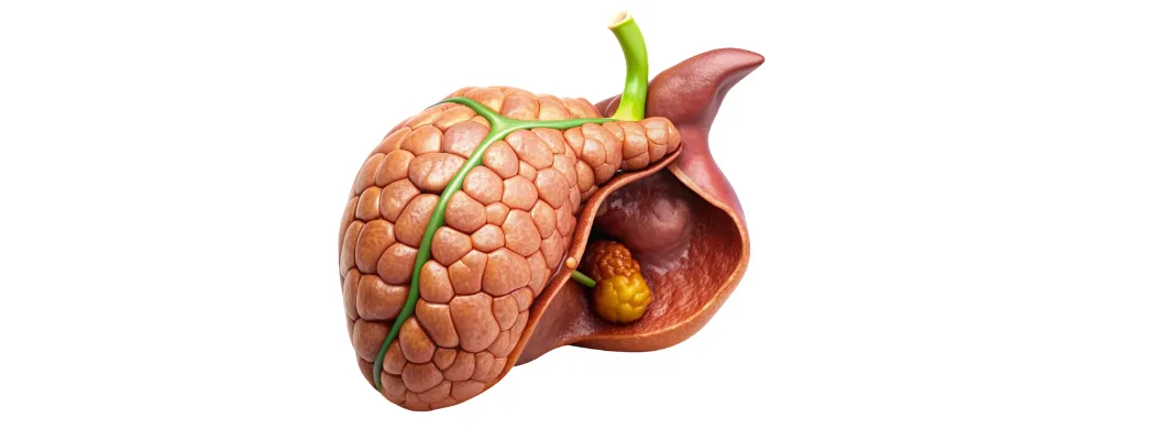 Gallstone Treatment Options: Which One Is Right for You?