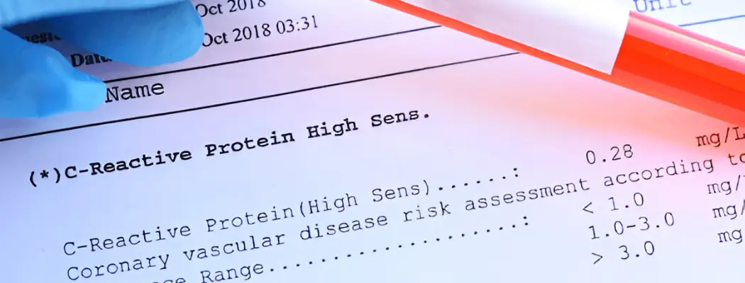 CRP high sensitivity blood test report with sample tube