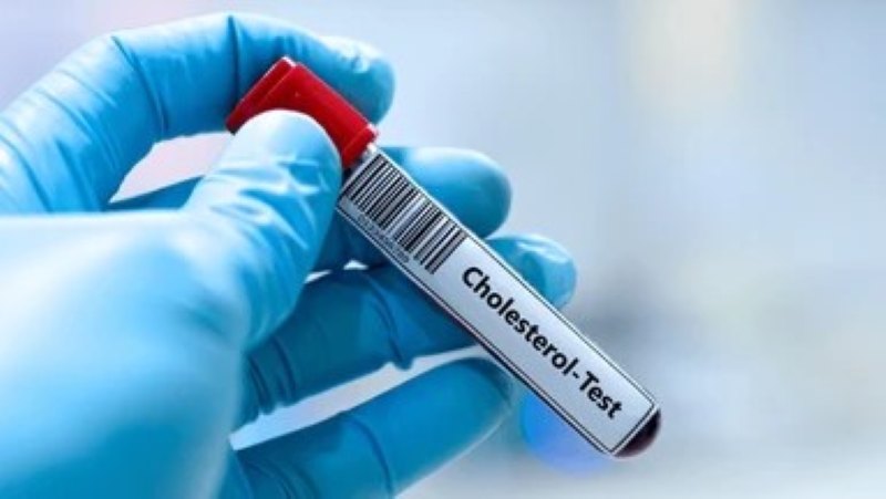 Understanding Cholesterol Reports: How to Interpret and Manage Your Levels