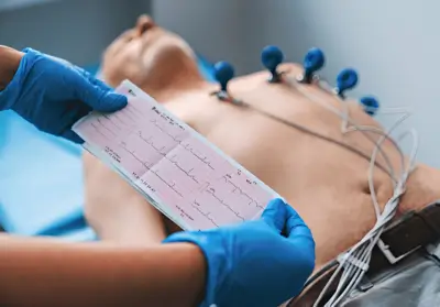 How to Read and Understand an ECG Report (Even If You're Not a Doctor)