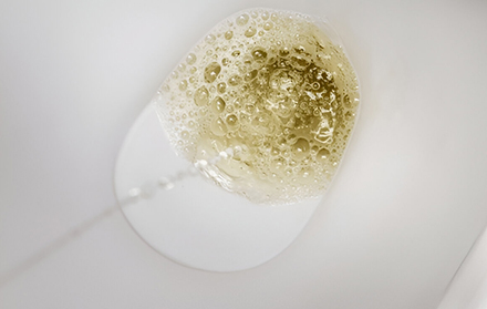Foamy Urine: What are the Causes and Treatment?
