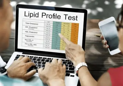 Lipid Profile Reports: Protect Your Heart with the Right Numbers