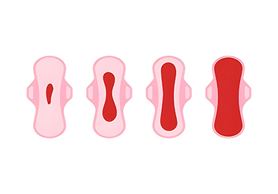 Heavy Menstrual Bleeding – Causes, Symptoms and Treatment Options (OBGYN)