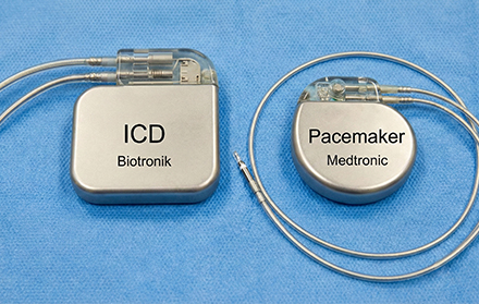 Pacemaker vs. ICD – What’s the Difference?