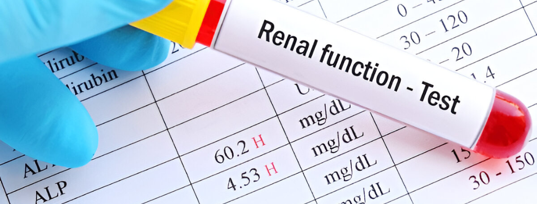 How to Reduce High Creatinine Levels Naturally?