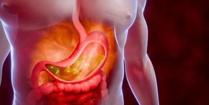 Hyperacidity: Causes, Signs, Symptoms, and How to Cure