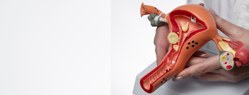 Early Symptoms of Uterine Fibroids Most Women Overlook 