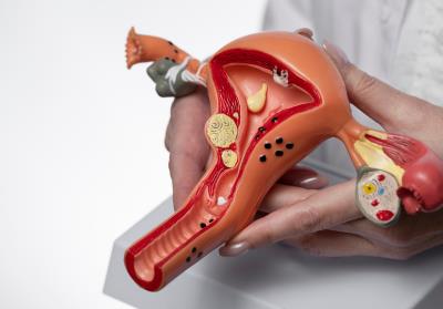 Early Symptoms of Uterine Fibroids Most Women Overlook 