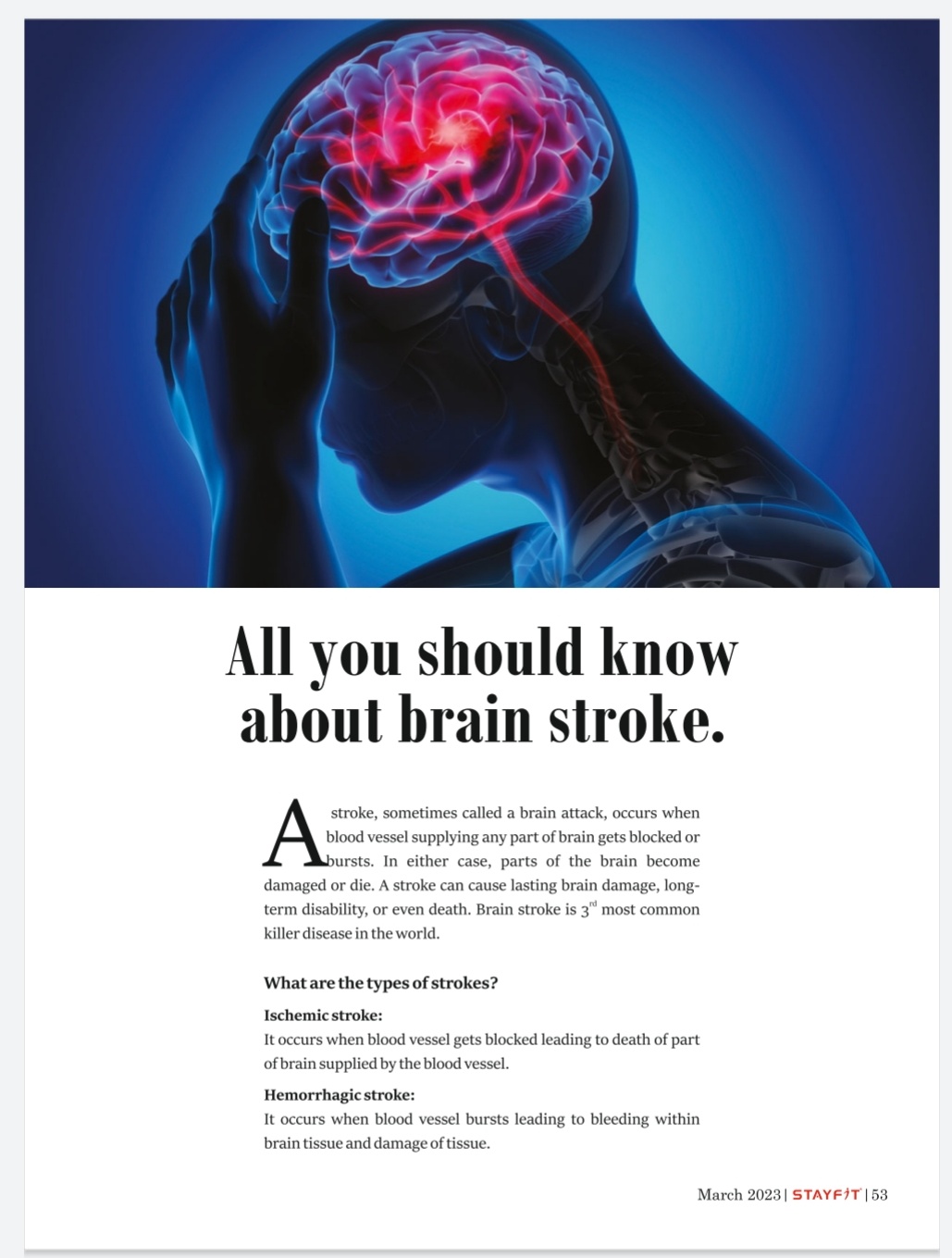 All vou should know about brain stroke