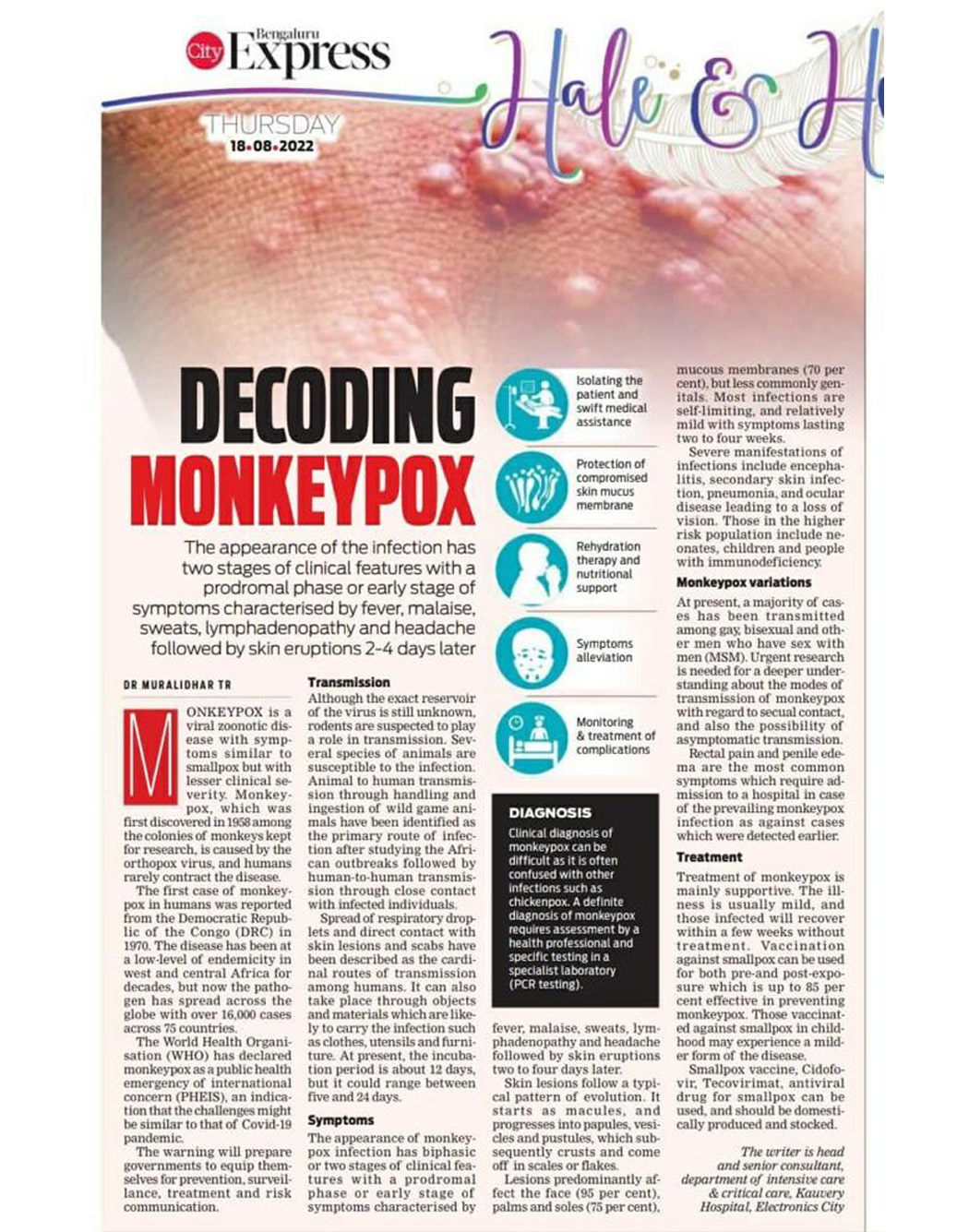 Decoding Monkey Pox