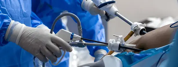 doctors performing laparoscopic surgery