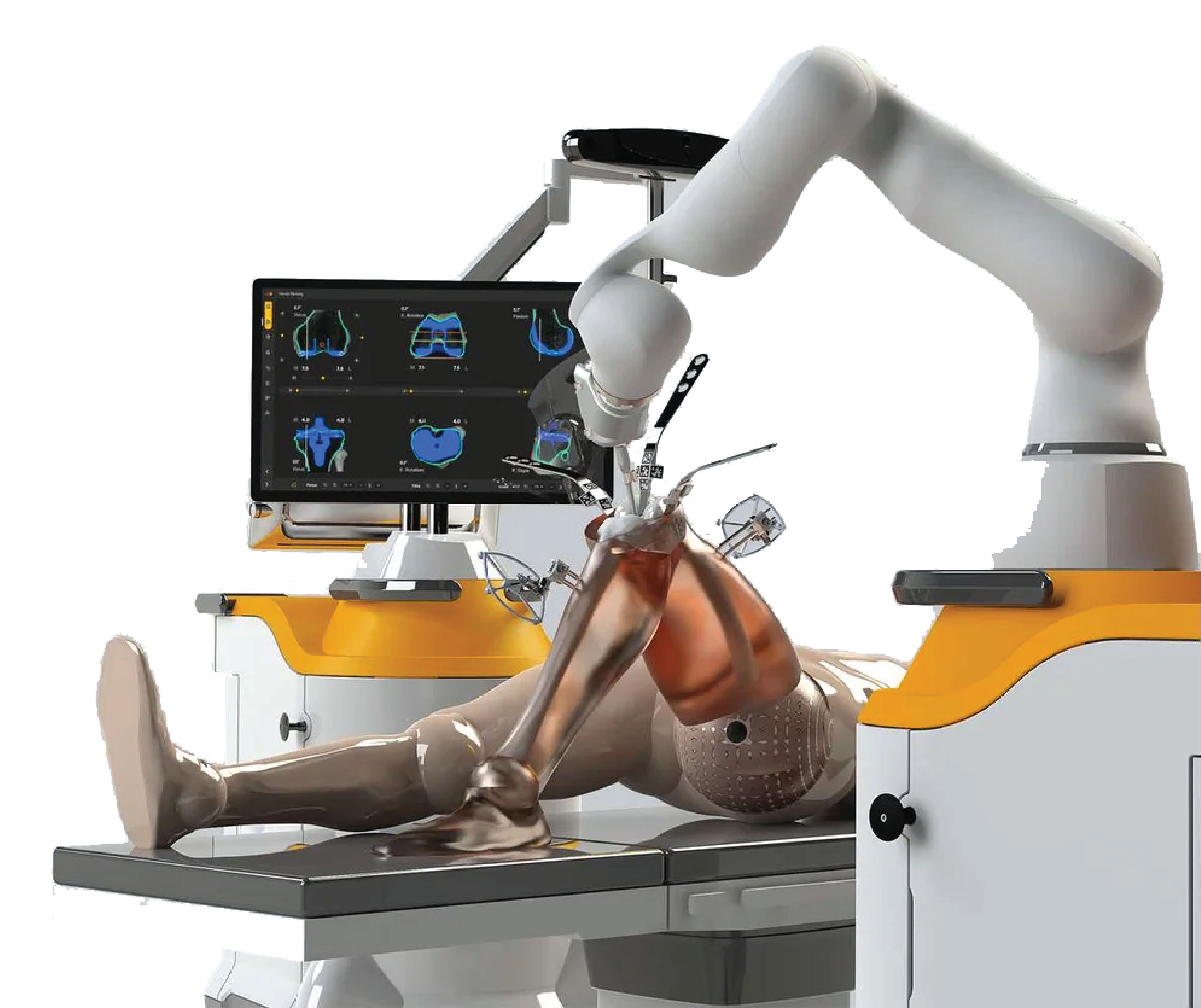 Robotic Surgery